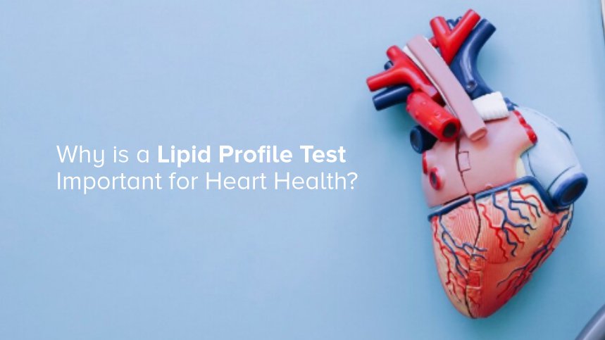 Why a Lipid Profile Test is Crucial for Heart Health